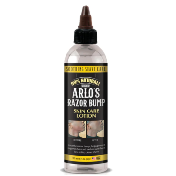 Arlo's Razor Bump Skin Care Lotion 177ml